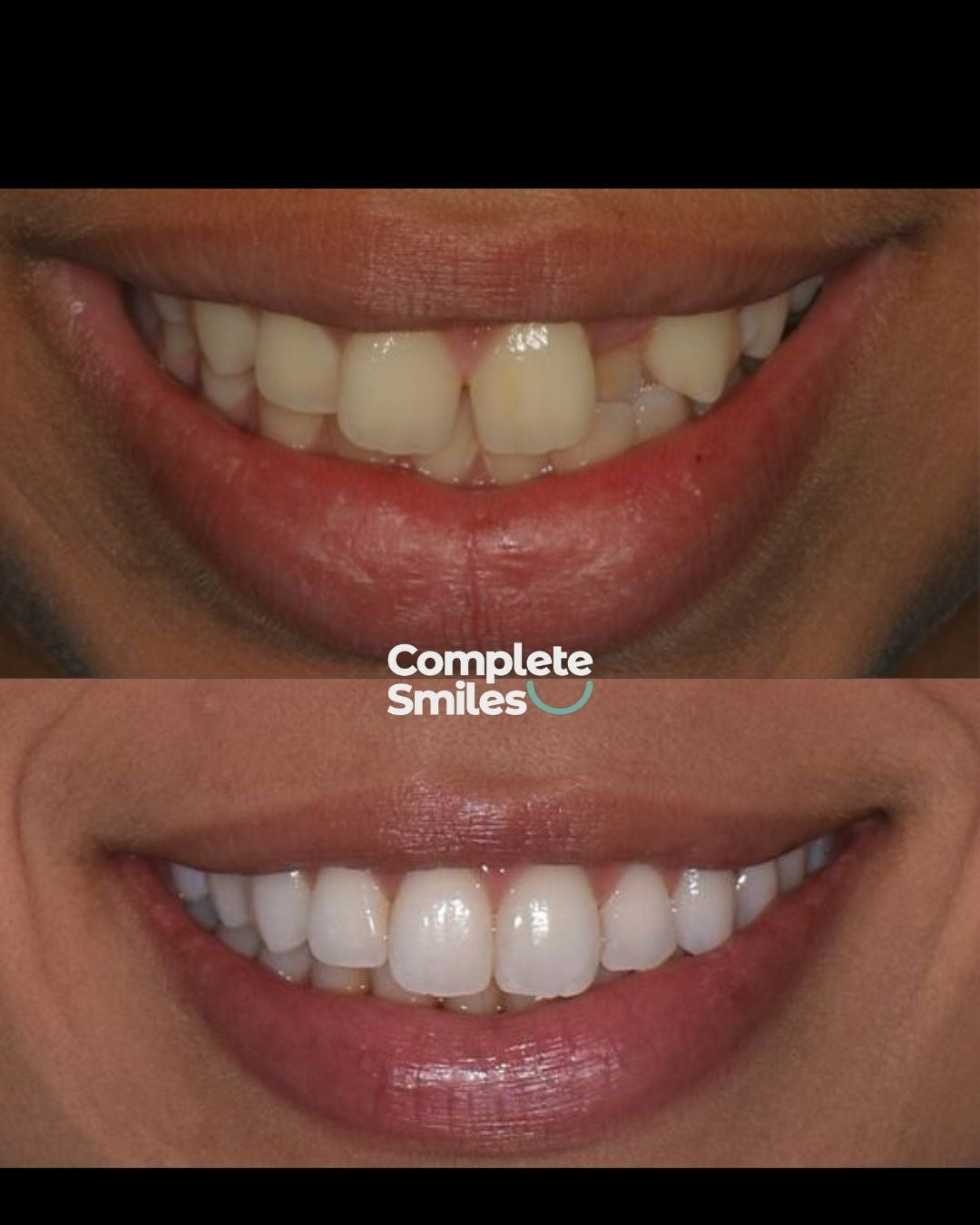 Complete Smiles, Harrow Town Centre